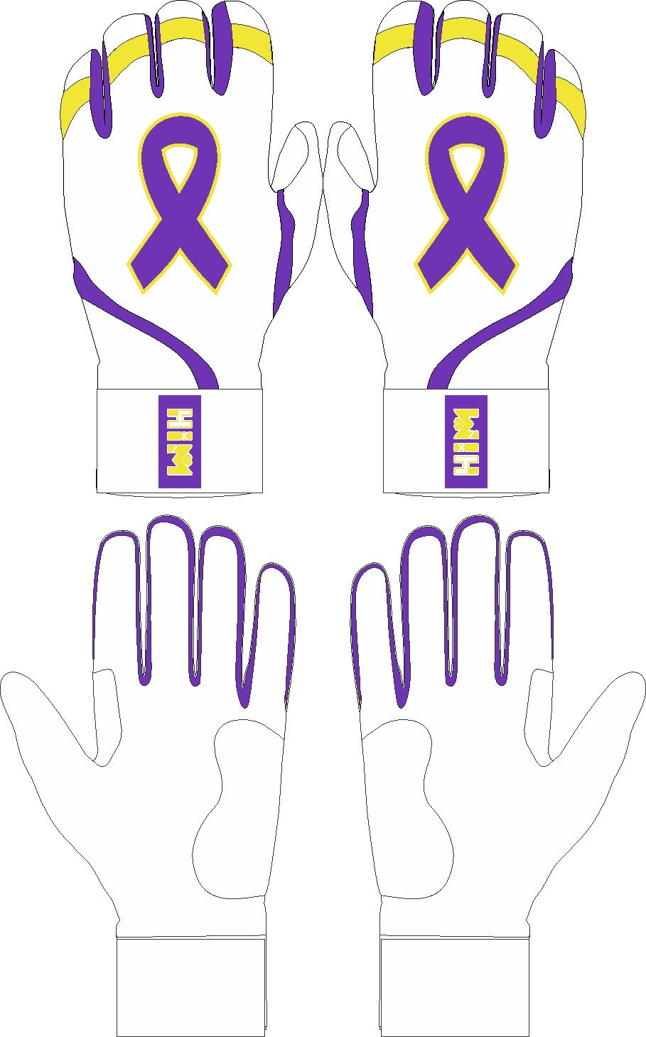 Autoimmune Disease Awareness White / Purple  [PRE-ORDER SALE | 1 week ]